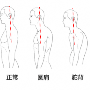 《按享健康》第32期-圓肩駝背